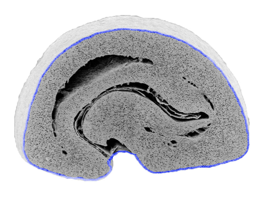 Microscopic cross section of coffee bean with water reaching only the outer layer of cells